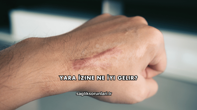 Yara İzine Ne İyi Gelir?