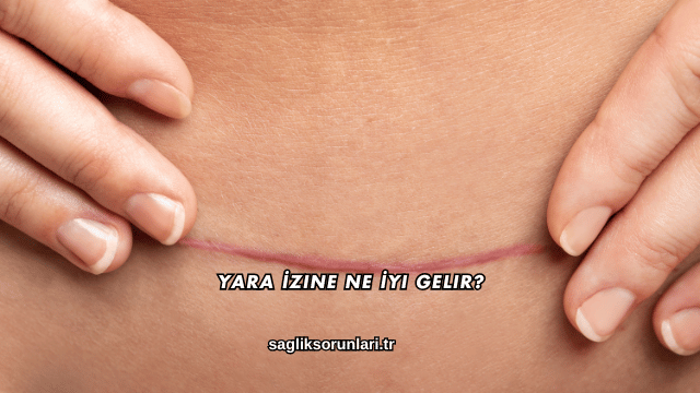 Yara İzine Ne İyi Gelir?