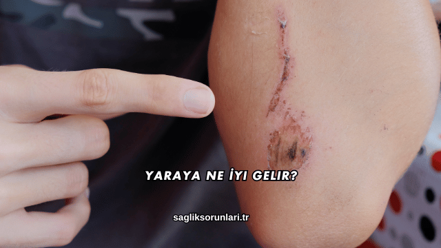 Yaraya Ne İyi Gelir?