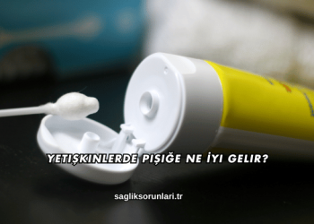 Yetişkinlerde Pişiğe Ne İyi Gelir?