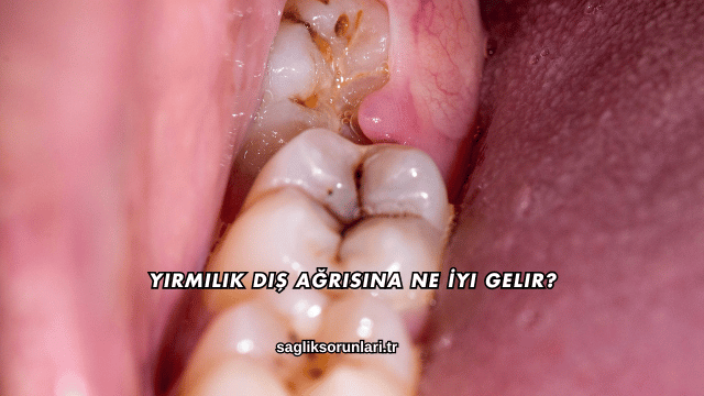 Yirmilik Diş Ağrısına Ne İyi Gelir?