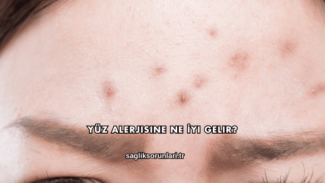 Yüz Alerjisine Ne İyi Gelir?