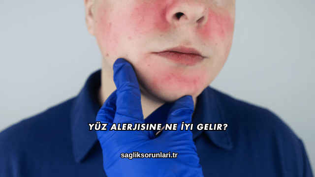 Yüz Alerjisine Ne İyi Gelir?