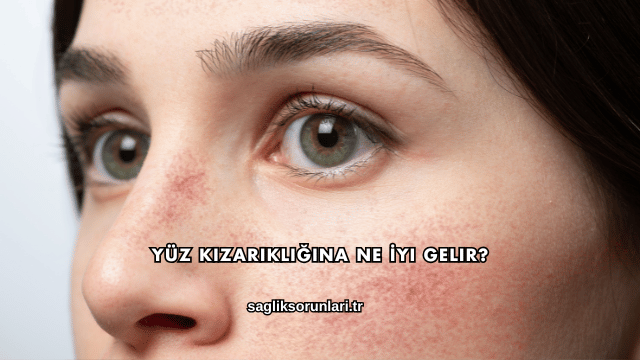 Yüz Kızarıklığına Ne İyi Gelir?