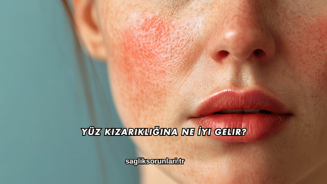 Yüz Kızarıklığına Ne İyi Gelir?
