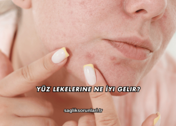 Yüz Lekelerine Ne İyi Gelir?