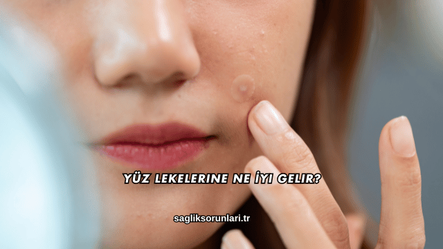 Yüz Lekelerine Ne İyi Gelir?