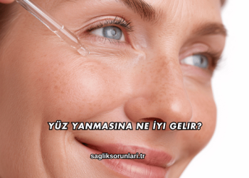 Yüz Yanmasına Ne İyi Gelir?