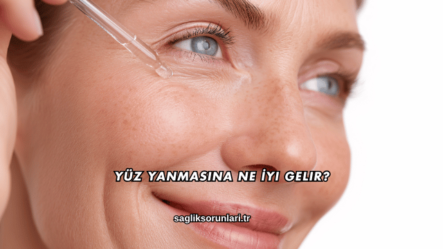 Yüz Yanmasına Ne İyi Gelir?