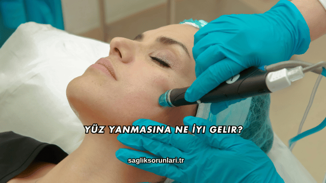 Yüz Yanmasına Ne İyi Gelir?