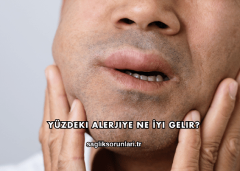 Yüzdeki Alerjiye Ne İyi Gelir?