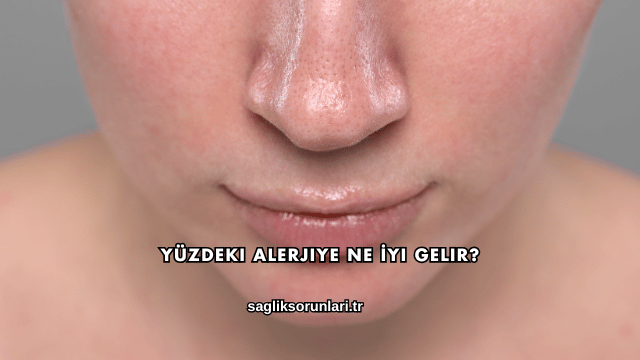 Yüzdeki Alerjiye Ne İyi Gelir?