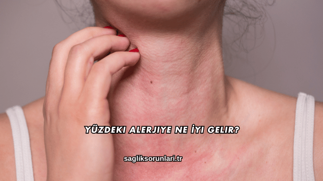 Yüzdeki Alerjiye Ne İyi Gelir?