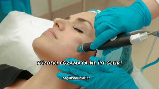 Yüzdeki Egzamaya Ne İyi Gelir?