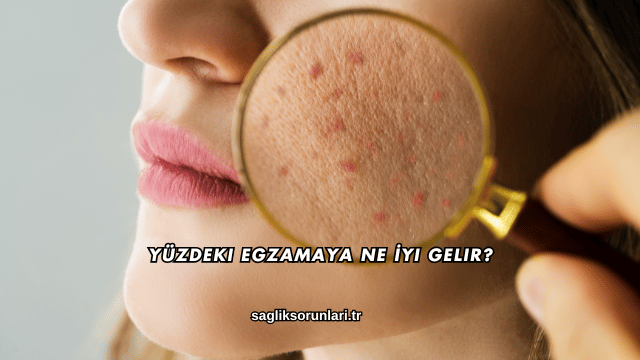 Yüzdeki Egzamaya Ne İyi Gelir?