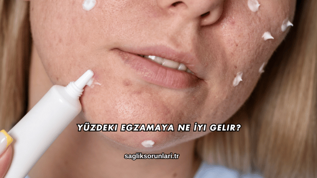 Yüzdeki Egzamaya Ne İyi Gelir?