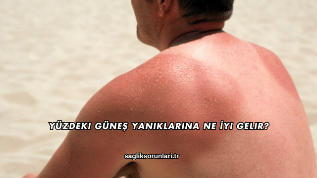 Yüzdeki Güneş Yanıklarına Ne İyi Gelir?