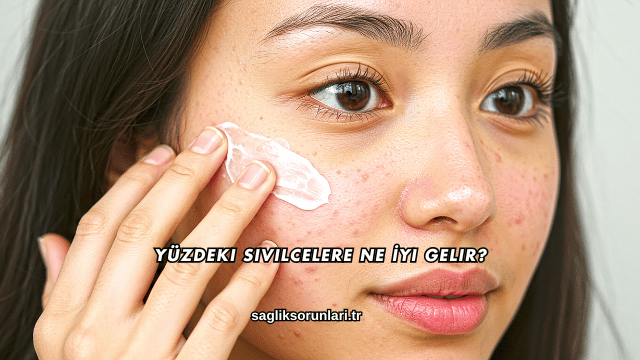 Yüzdeki Sivilcelere Ne İyi Gelir?