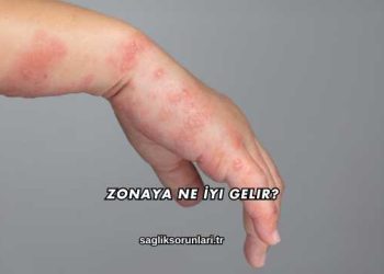 Zonaya Ne İyi Gelir?