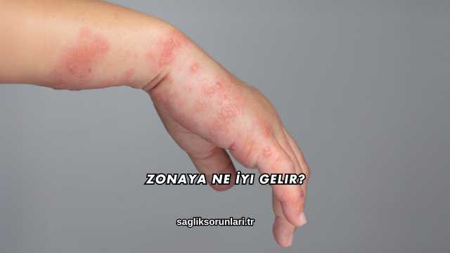 Zonaya Ne İyi Gelir?