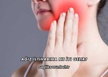 Ağız İltihabına Ne İyi Gelir?