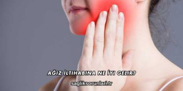 Ağız İltihabına Ne İyi Gelir?