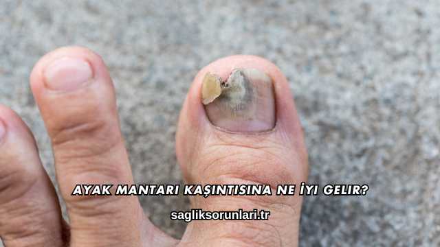 Ayak Mantarı Kaşıntısına Ne İyi Gelir?