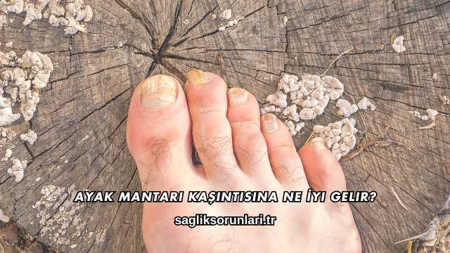 Ayak Mantarı Kaşıntısına Ne İyi Gelir?
