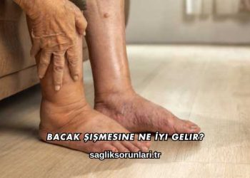 Bacak Şişmesine Ne İyi Gelir?