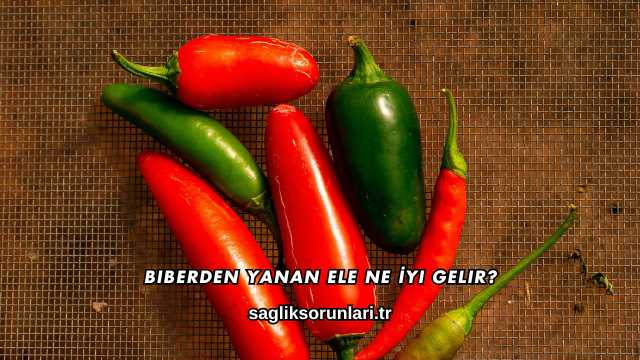 Biberden Yanan Ele Ne İyi Gelir?