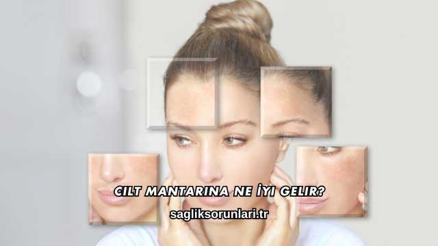 Cilt Mantarına Ne İyi Gelir?