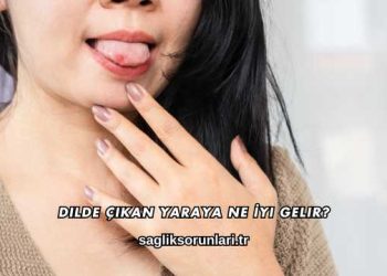Dilde Çıkan Yaraya Ne İyi Gelir?
