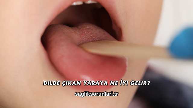 Dilde Çıkan Yaraya Ne İyi Gelir?