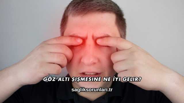Göz Altı Şişmesine Ne İyi Gelir?