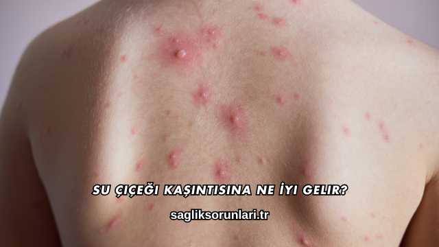 Su Çiçeği Kaşıntısına Ne İyi Gelir?