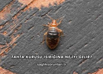 Tahta Kurusu Isırığına Ne İyi Gelir?